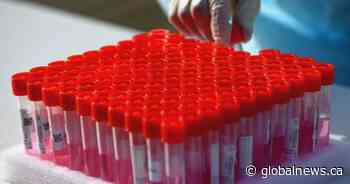 COVID-19: 2 new deaths in Saskatchewan as total infections surpass 47K