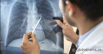 COVID-19: Zero deaths reported in Saskatchewan, 89 new cases