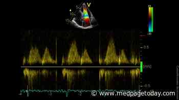 Op-Ed: Does Your Patient Really Have Diastolic Dysfunction?