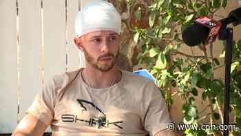 Man looking for shark teeth survives an alligator bite to his head