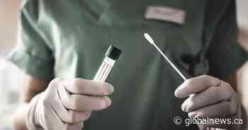 COVID-19: Saskatchewan reports 3 new deaths, 2nd lowest daily infections of 2021