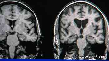 Rhode Island played a role in research for newly FDA approved drug treatment for Alzheimer's - WLNE-TV (ABC6)