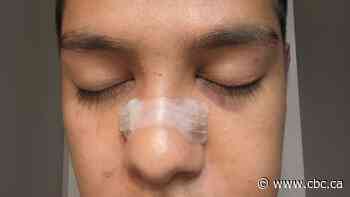 Ottawa Redblacks suspend Chris Larsen amid investigation into possibly hate-motivated beating