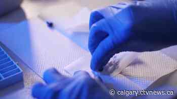 Calgary businessman, U of C partner for exploration into psychedelics as mental health treatment for Canadians - CTV Toronto