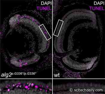 Japanese Rice Fish Model of a Rare Human Metabolic Disorder