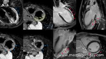 Myocarditis and COVID Vaccines: Where Do We Stand?