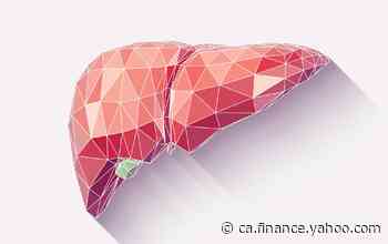 Wake Forest teams win a NASA prize for 3D printing human liver tissue - Yahoo Canada Finance