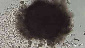 An Omega-3 That’s Poison for Cancer Tumors