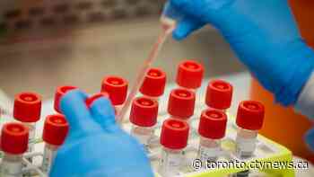 Ontario reports more than 500 new COVID-19 cases for fourth straight day