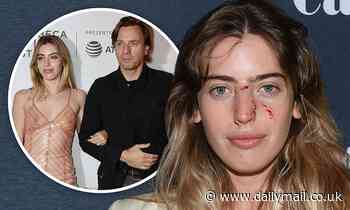 Ewan McGregor's daughter Clara McGregor has to go to emergency room