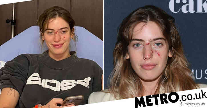 Ewan McGregor’s daughter Clara sports painful cuts to face as she’s bitten by dog right before red carpet