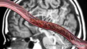 Direct Angiography Gains Credence for Hospitals Receiving Stroke Transfers