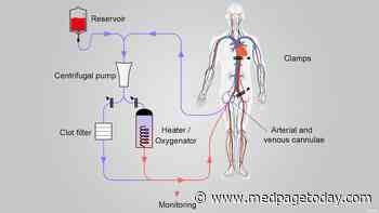 ACP: Pump the Brakes on New Organ Procurement Method