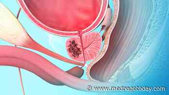 What’s Guiding Prostate Cancer Care in Gay Men?