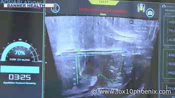 New prostate enlargement procedure at Mesa medical center offers relief, less side effects - FOX 10 News Phoenix