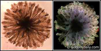 Scientists Make Big Progress in Building Mini-Kidneys – “Essential Milestone Towards Building a Functional Organ”