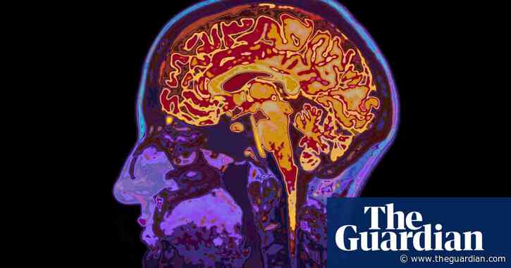Four unhelpful myths about dementia: ‘Our bleak view is often unjustified’