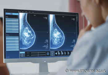 AI breast cancer screening project wins government funding for NHS trial - Imperial College London