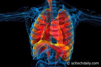 Rare but Possible: COVID-19-Related Multisystem Inflammatory Syndrome in Adults