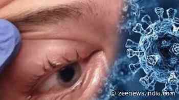 First ever case of `Optic Neuritis` after black fungus; Kanpur authorities on alert