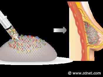 3D Systems, CollPlant aim to develop bioprinted breast reconstruction procedures