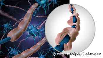 Unusual Variant of Guillain-Barré Syndrome Linked to COVID Vaccines