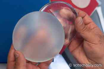 Toward Safer Breast Implants: How Implant Surfaces Affect Immune Response