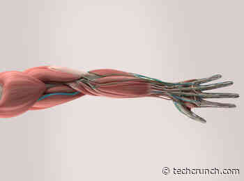 Musculoskeletal medical startups race to enter personalized health tech market - TechCrunch