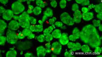 What happened to beating heart cells sent to space can help save patients