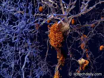 Toxicity of Protein Involved in Alzheimer’s Triggered by Chemical “Switch”
