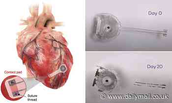 World's first wireless, battery-free, fully implantable pacemaker DISSOLVES within seven weeks