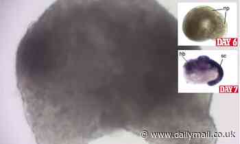 Mouse embryo with beating heart and nervous system is grown in a lab using stem cells