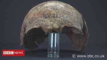 5,000-year-old man was 'oldest plague victim'