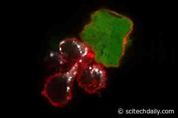 Immunotherapy That Supercharges the Immune System’s Natural Killer Cells Shows Promise Against Melanoma