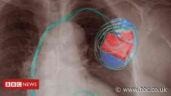 Apple lists products that pose risk to pacemakers