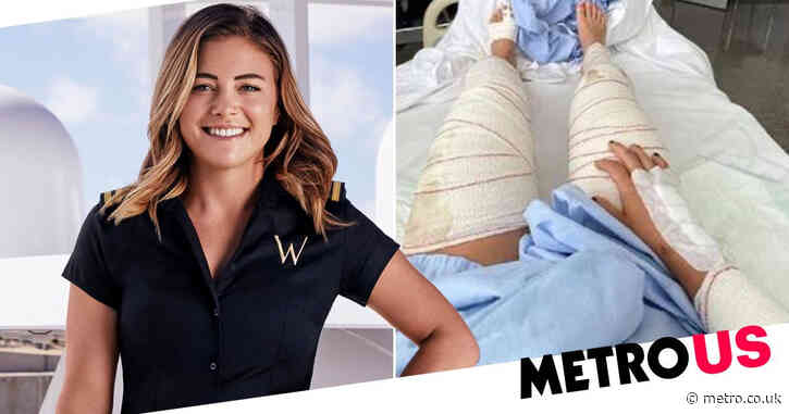 Below Deck Med’s Malia White suffers broken toes and fractured elbow after severe scooter accident: ‘My helmet saved my life’