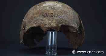 Scientists unearth 5,000-year-old plague victim: He likely died a slow death     - CNET