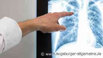 Corona: 2,7 Millionen Euro für Therapien gegen Covid-19 gehen an die Uni Ulm