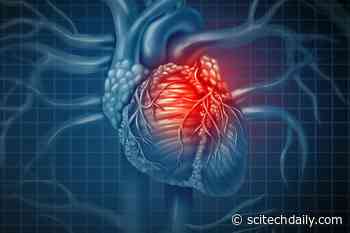 Ultra-Processed Foods Are Breaking Your Heart – Increased Risk of Cardiovascular Disease, Death