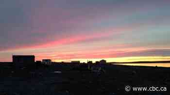 Wait-list for children's dental surgery in Nunavut has doubled to 1,000