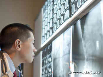 RMIT University researchers train AI to detect early-stage prostate cancer