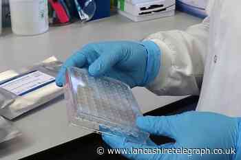 Men more likely than women to test positive for coronavirus, study suggests