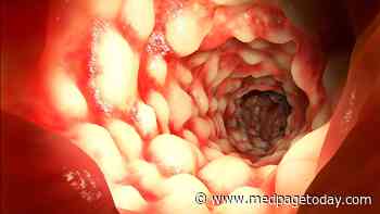Adults With Obesity See Increased Risk for Crohn's Disease