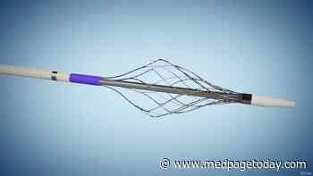 To Master Stroke Thrombectomy, It Takes Way More Than 50 Cases