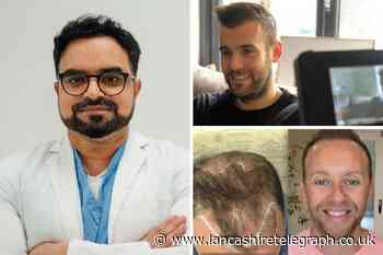 The hair transplant surgeon who helped North West celebs
