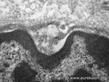 Novel coronavirus infects and replicates in salivary gland cells - EurekAlert