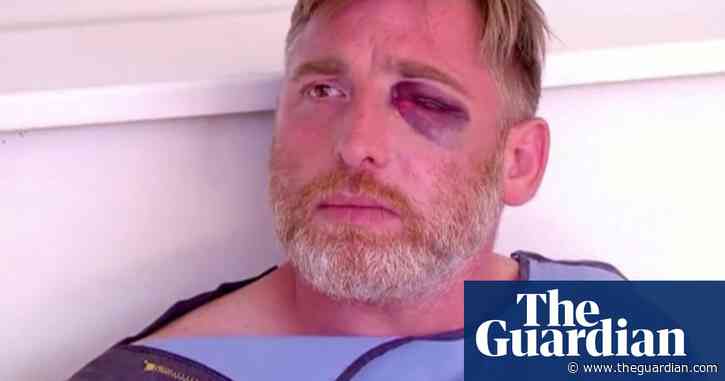 Georgian cameraman dies after attack by far-right, anti-LGBTQ mob