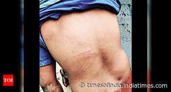 Tribals thrash 2 forest officials in Telangana's Mulugu district - Times of India