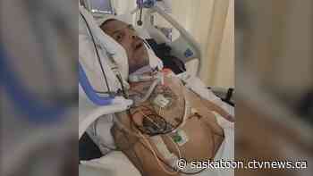 Saskatoon man struggles to regain motor function weeks after he was Tased by police, son says - CTV News Saskatoon