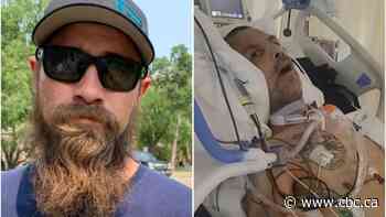 Son seeks witnesses to Saskatoon police altercation that left his dad in ICU with brain injury - CBC.ca